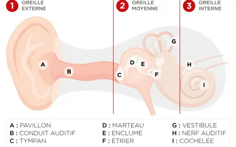 Schéma de l'oreille montrant les différentes parties. La cochlée (I) contient les cellules ciliées endommagées, essentielles à l'audition.