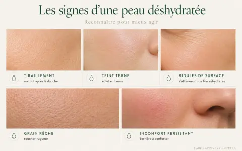 Les signes d'une peau déshydratée : tiraillements, teint terne, ridules, grain rêche et inconfort. Reconnaître ces signes pour mieux agir.
