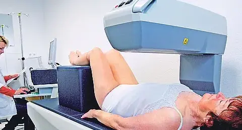 Osteoporose Diagnostik: Wichtige Tests und Risikofaktoren verstehen