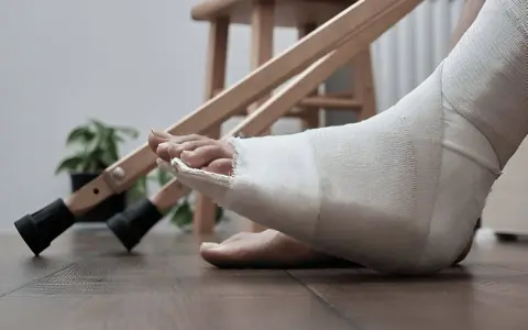 Noga w opatrunku, przygotowanie do rehabilitacji palca po złamaniu. Obok stoją kule.