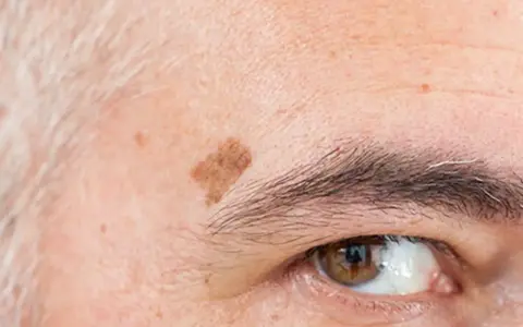 Gros plan sur le coin de l'œil d'une personne âgée, montrant des taches de vieillesse sur la peau et des sourcils poivre et sel.