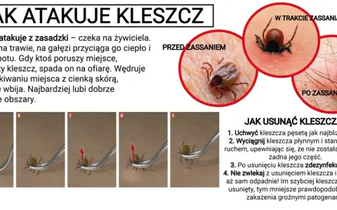 Kleszcz pod skórą to mit! Jak rozpoznać i bezpiecznie usunąć?