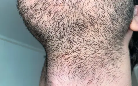 Barba incipiente y cuello con vello corto. Para una piel suave, es bueno afeitarse todos los días.