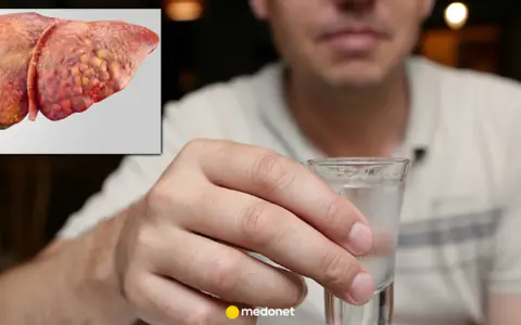 Chora wątroba obok kieliszka alkoholu. Zastanawiasz się, jak długo regeneruje się wątroba po uszkodzeniu?