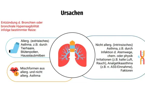 Ursachen von Asthma: Allergisches Asthma durch Reize wie Tierhaare, Pollen, Hausstaubmilben. Nicht-allergisches Asthma durch Infektionen, Kälte, Rauch oder Medikamente. Mischformen sind ebenfalls möglich.