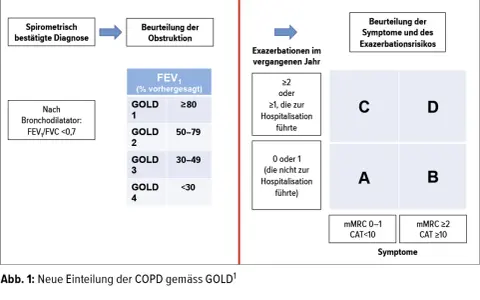 Schema zur Einteilung der COPD-Stadien nach GOLD, basierend auf Obstruktion, Exazerbationen und Symptomen.
