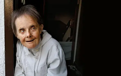 Portret kobiety z zespołem Downa w jasnej kurtce, patrzącej w bok.
