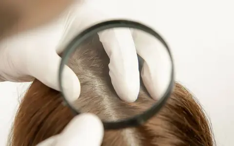 Wie viele Haare hat der Mensch? Die überraschende Antwort