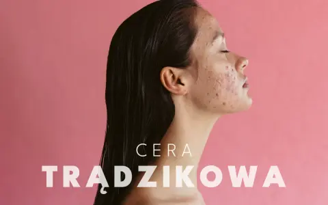 Cera trądzikowa: Jak dbać? Kompletny poradnik ekspertki