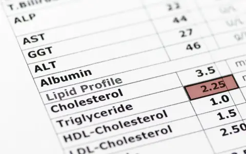 Wynik lipidogramu: trójglicerydy 1.5 mmol/l, co mieści się w normie. Wynik cholesterolu 2.25 mmol/l.