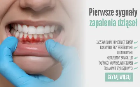 Zapalenie dziąseł: 7 objawów, których nie wolno ignorować!