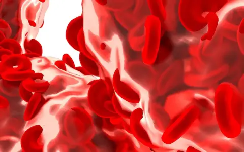 Podwyższona hemoglobina: Kiedy martwić się wynikiem badań?