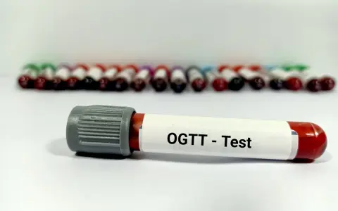 Probówka z oznaczeniem "OGTT - Test" na tle wielu innych próbek krwi. To ważny etap w diagnostyce cukrzycy, czyli test obciążenia glukozą.
