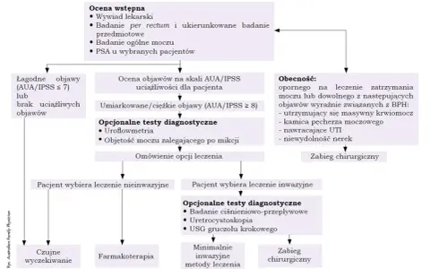 Schemat diagnostyczny BPH: USG gruczołu krokowego jako jedna z opcji po ocenie objawów i wyborze leczenia inwazyjnego.