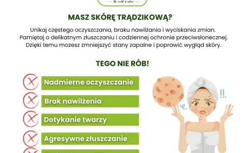Jak dbać o cerę trądzikową? Skuteczny plan i błędy do unikania
