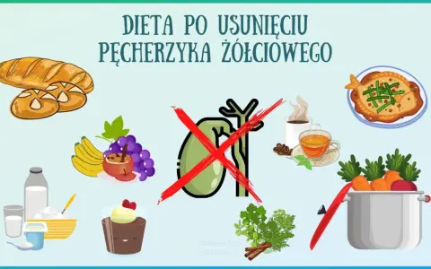Zdrowe jedzenie po usunięciu woreczka żółciowego: pieczywo, owoce, nabiał, ryba, warzywa. Unikaj kawy i słodkości.
