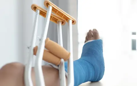 Noga w niebieskim gipsie, z kulami obok, sugeruje złamanie podudzia łącznie ze stawem skokowym.