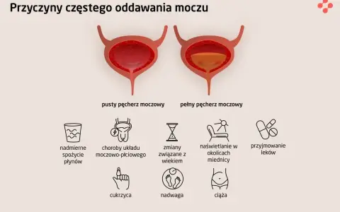Ilustracja przedstawia przyczyny częstego oddawania moczu w dużych ilościach: nadmierne picie, choroby układu moczowo-płciowego, wiek, naświetlanie, leki, cukrzyca, nadwaga, ciąża.