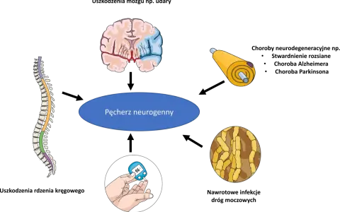 Ilustracja przedstawia mózg, rdzeń kręgowy, neuron i glukometr, sugerując, czy pęcherz neurogenny da się wyleczyć.