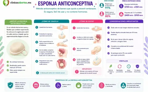 La esponja anticonceptiva es un método de barrera suave y flexible que se coloca en la vagina para prevenir embarazos.