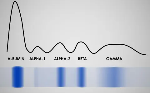 Wykres elektroforezy białek surowicy, pokazujący normę. Widoczne pasma albumin, alfa-1, alfa-2, beta i gamma.