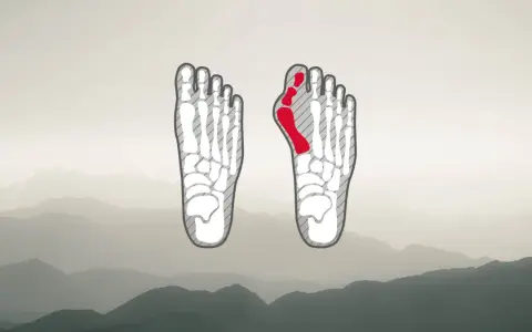 Fußskelett mit rot markiertem Ballenbereich, ideal für die Auswahl von hallux wanderschuhen.
