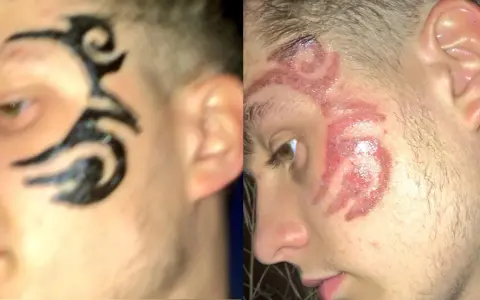 Henna do brwi jako tatuaż? Ryzykujesz zdrowie i blizny!