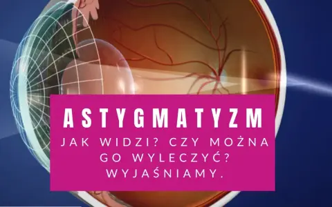 Astygmatyzm: jak widzi oko? Czy można go wyleczyć? Wyjaśniamy. Wizyta u okulisty lub optometrysty pomoże.