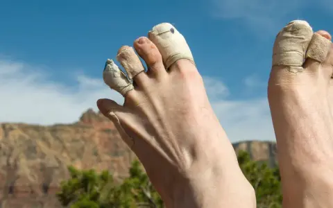 Zehen tapen wandern: Füße mit getapten Zehen ruhen nach einer langen Wanderung im Grand Canyon.