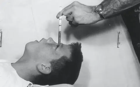 En hand för in en lobotomikniv i en patients öga. En mörk period i psykiatrins historia, även i Sverige.