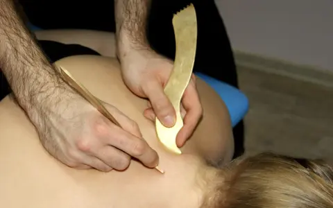 Terapeuta wykonuje zabieg pinopresury, używając złotych narzędzi do stymulacji punktów na plecach pacjenta.