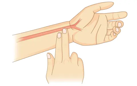 Zwei Finger auf dem Handgelenk, um den Puls zu messen. Eine Arterie ist sichtbar.