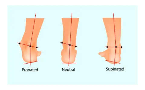 Illustrazione che mostra la pronazione e supinazione del piede: pronato, neutro e supinato, con linee rosse che indicano l'allineamento.