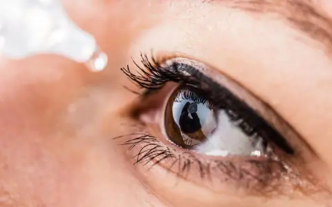 Gocce per la cura dell'occhio secco che cadono su un occhio marrone.