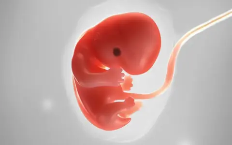 Ein roter Embryo mit Nabelschnur, dargestellt als Ultraschall 7 ssw.