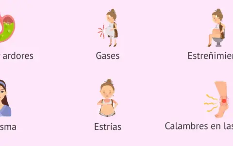 Ilustraciones de síntomas comunes del embarazo: reflujo, gases, estreñimiento, cloasma, estrías y calambres en las piernas. Semana 25.