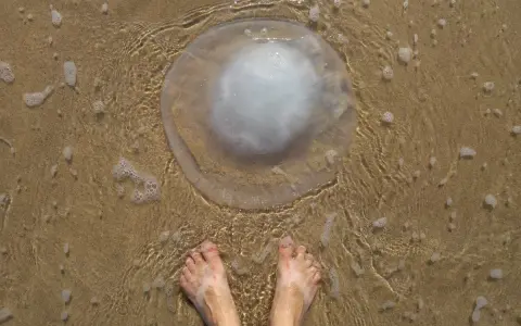 Piedi sulla sabbia bagnata vicino a una grande medusa trasparente. Cosa fare se ti tocca una medusa? Non toccarla!