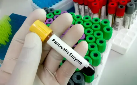 Ręka w rękawiczce trzyma probówkę z napisem "Pancreatic Enzyme", gotową do analizy. W tle widać wiele innych probówek.