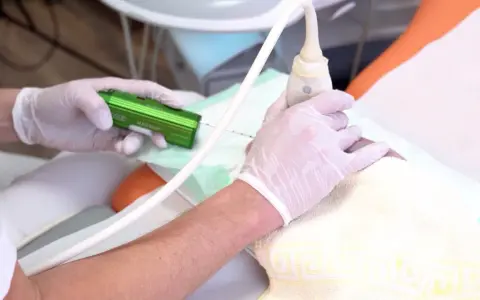 Arzt führt eine Brust-Biopsie mit einem speziellen Gerät durch. Hände in Handschuhen halten die Nadel und den Ultraschallkopf.