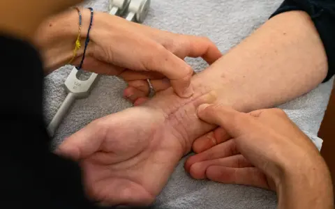 Mani esperte che mostrano come massaggiare una cicatrice sul polso, con un diapason in primo piano.