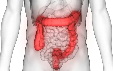 Anatomia jelita grubego podświetlona na czerwono na tle przezroczystego ciała ludzkiego.