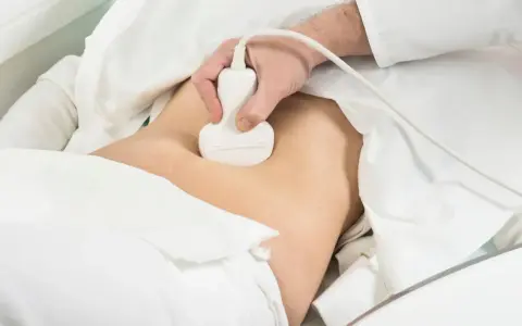 Lekarz wykonuje badanie usg prostaty. Pacjent leży pod białym obrusem, a sonda aparatu USG jest przykładana do brzucha.