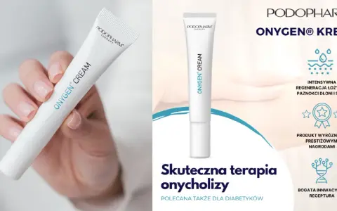 Krem ONYGEN® do intensywnej regeneracji paznokci dłoni i stóp, polecany w terapii onycholizy.