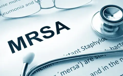 Documento con la scritta MRSA, stetoscopio e occhiali. Il batterio MRSA è una preoccupazione medica.
