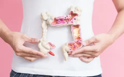 Model jelita grubego z widocznym polipem jelita grubego 3 cm. Dłonie trzymają model, podkreślając jego szczegóły.