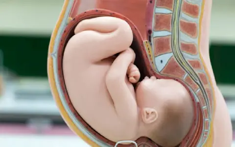 Model anatomiczny przedstawia dziecko w łonie matki w prawidłowym **położeniu główkowym**.
