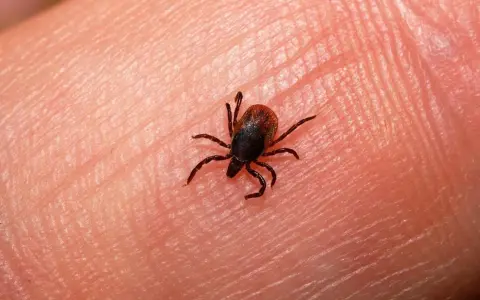 Una garrapata pequeña, con ocho patas, se arrastra sobre la piel humana.