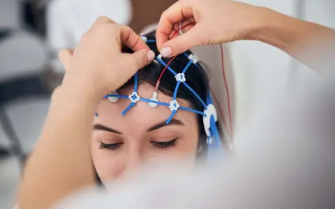 Eine Person erhält eine EEG-Untersuchung. Elektroden werden auf dem Kopf platziert, um die Gehirnaktivität zu messen.