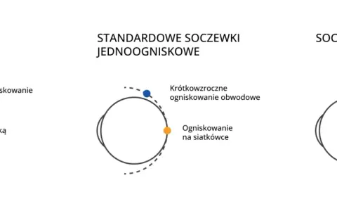 Schemat oka z ogniskowaniem światła przy krótkowzroczności i korekcji soczewkami.