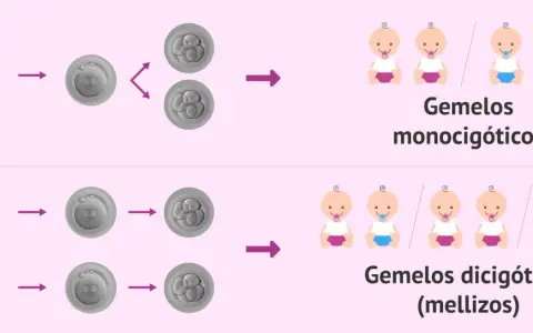 Ilustración muestra cómo un espermatozoide fecunda un óvulo, dando lugar a gemelos monocigóticos o dicigóticos. Tener gemelos depende del hombre o de la mujer.